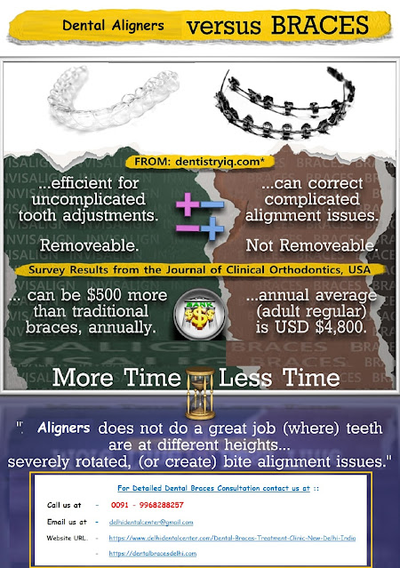 Dental Braces clinic Delhi, Dental Braces Delhi, orthodontist Delhi, Dental Braces in Delhi, Braces Dentist in Delhi, Braces Delhi, Braces Clinic in Delhi, Dental Braces Treatment in Delhi.