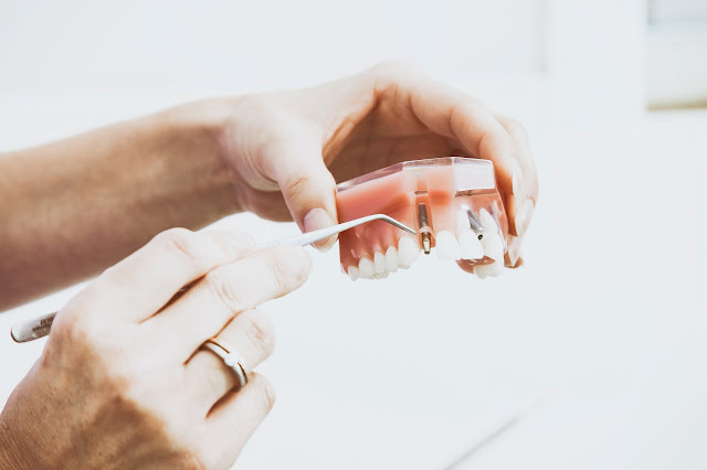What are the symptoms of dental implant infection?
