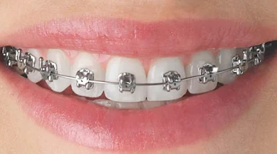orthodontist in Barsha