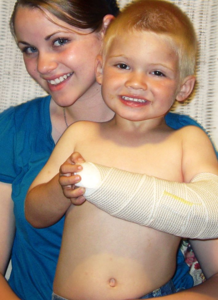 broken arm in cast. his sweet arm in a cast: