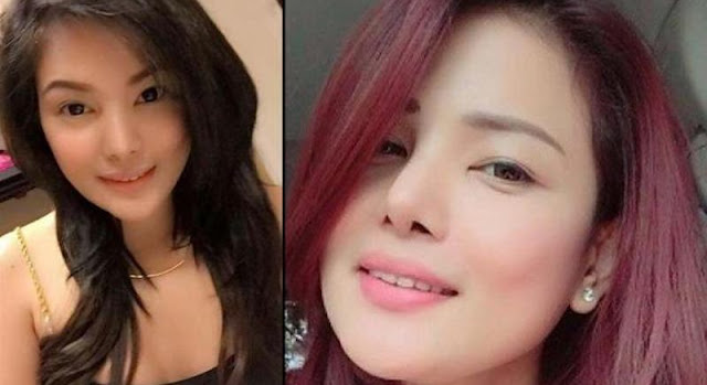 Ingin Lebih Cantik, Cewek Ini Malah Meninggal Dunia