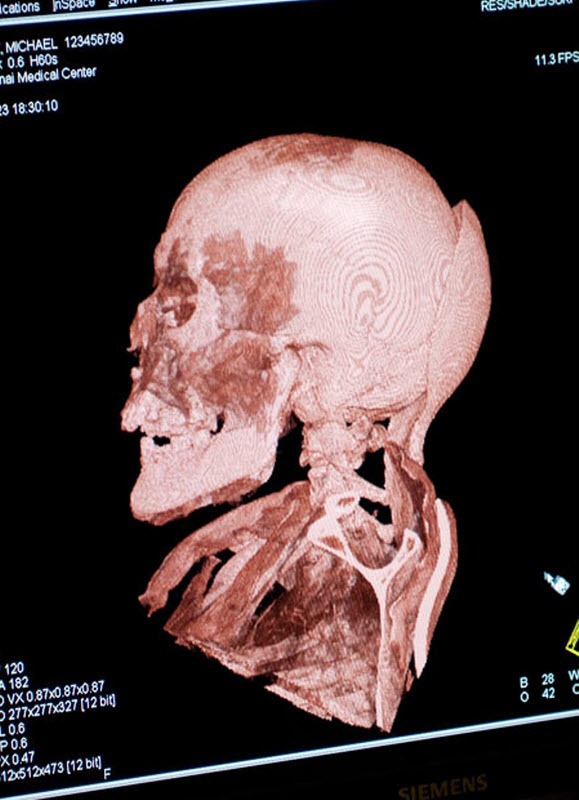 mummies (19)