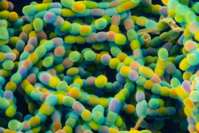 Это цветная сканирующая электронная микрофотография (СЭМ) цепочек спор почвенных бактерий Streptomyces.