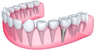 Best Dentist in Nagpur