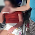 Mulher espanca filha adolescente e leva tapa de policial em Pernambuco