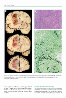 Greenfield's Neuropathology, 2 Volume Set,  8th Edition