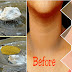 How To Get Rid Of Dark Neck Within 6 Hours