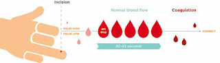 Pentingnya Pengambilan Sampel Darah Kapiler yang Baik pada POCT Hemoglobin