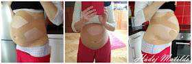 tejpování, tejpování v těhotenství, tejpování těhotenského břicha, kinesiotaping