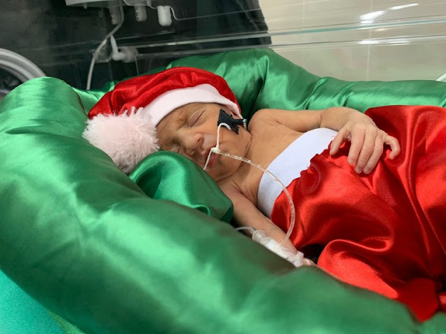 Maternidade Frei Damião celebra Natal com ensaio fotográfico para bebês prematuros