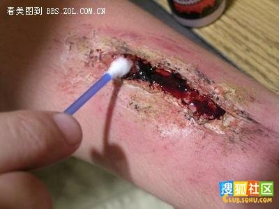 how to make open wounds
