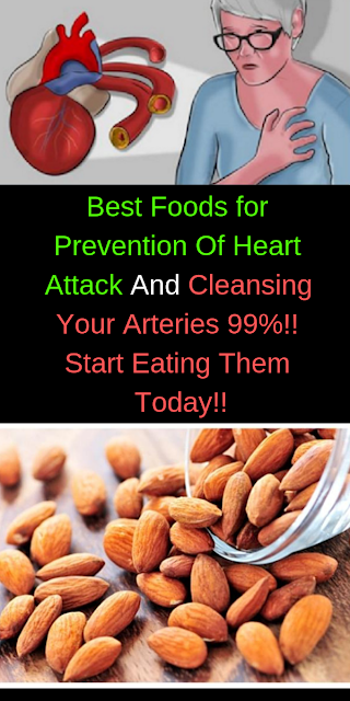 Best Foods for Prevention Of Heart Attack And Cleansing Your Arteries 99%!! Start Eating Them Today!!