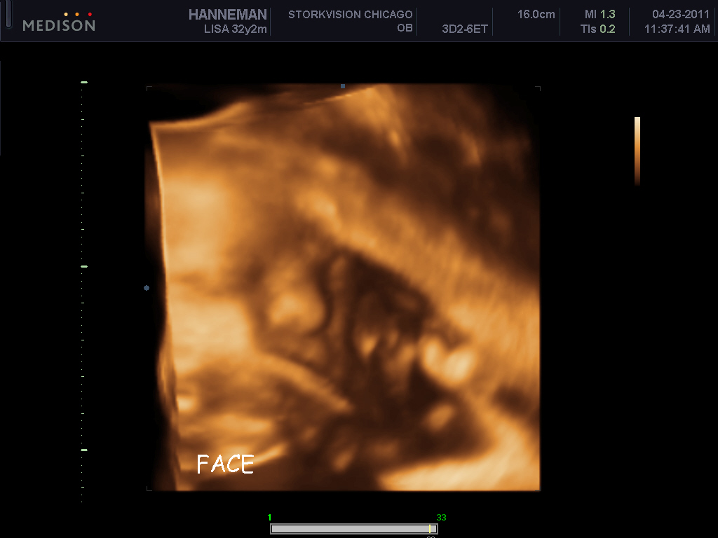 Wallpapers 3d 4d Ultrasound Equipment Pregnancy Ultrasound | Re ...