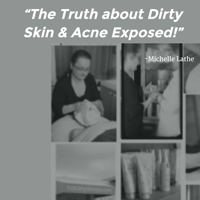 dirty, acne, breakouts, pimples, myths, truths