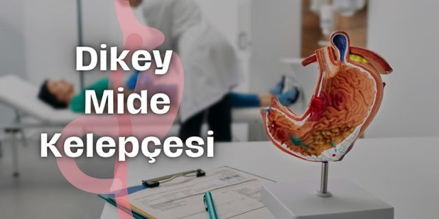 Dikey Mide Kelepçesi