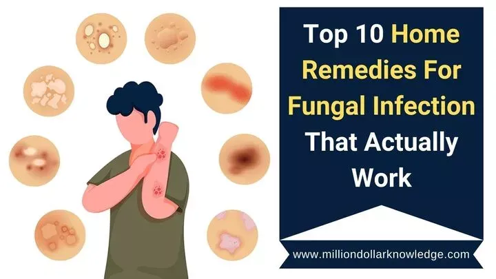 Home remedies for fungal infection