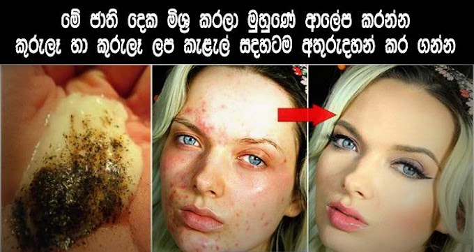 Mix These 2 Ingredients and Get Rid Of Acne And Acne Scars On Your Skin 