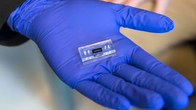 DNA-lab-on-chip