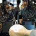 Latest Tech:Robots can reduce brain surgery time from 2hours to 2 Minutes