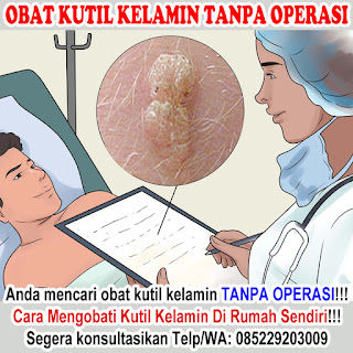 Obat Kutil Kelamin, Cara Mengobati Kutil Dikemaluan Kelamin Dari Rumah Sendiri, Dokter Obat Kutil Kelamin Terbukti Terbaik Dan Terpercaya