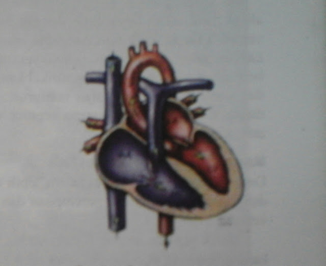 Penyakit Jantung Hipertensi