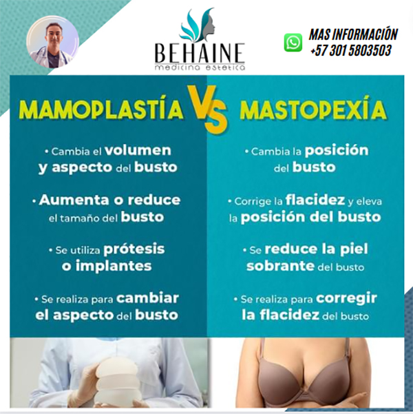 Cuales son las diferencias entre mamoplastia y mastopexia?