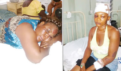 Survivors: Eno Etim (left) and Emem Akpanitiat at the St. Luke’s General Hospital, Uyo, Akwa Ibom State…on Sunday.