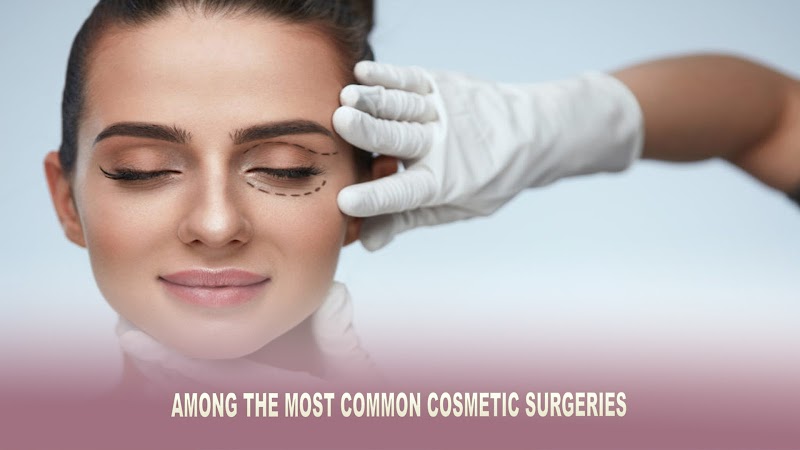 Among the Most Common Cosmetic Surgeries