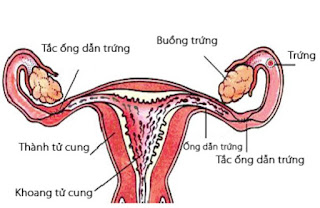 Những nguy biến do trục trặc phần phụ