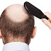 What Hair Loss Treatment Will Work Best for You