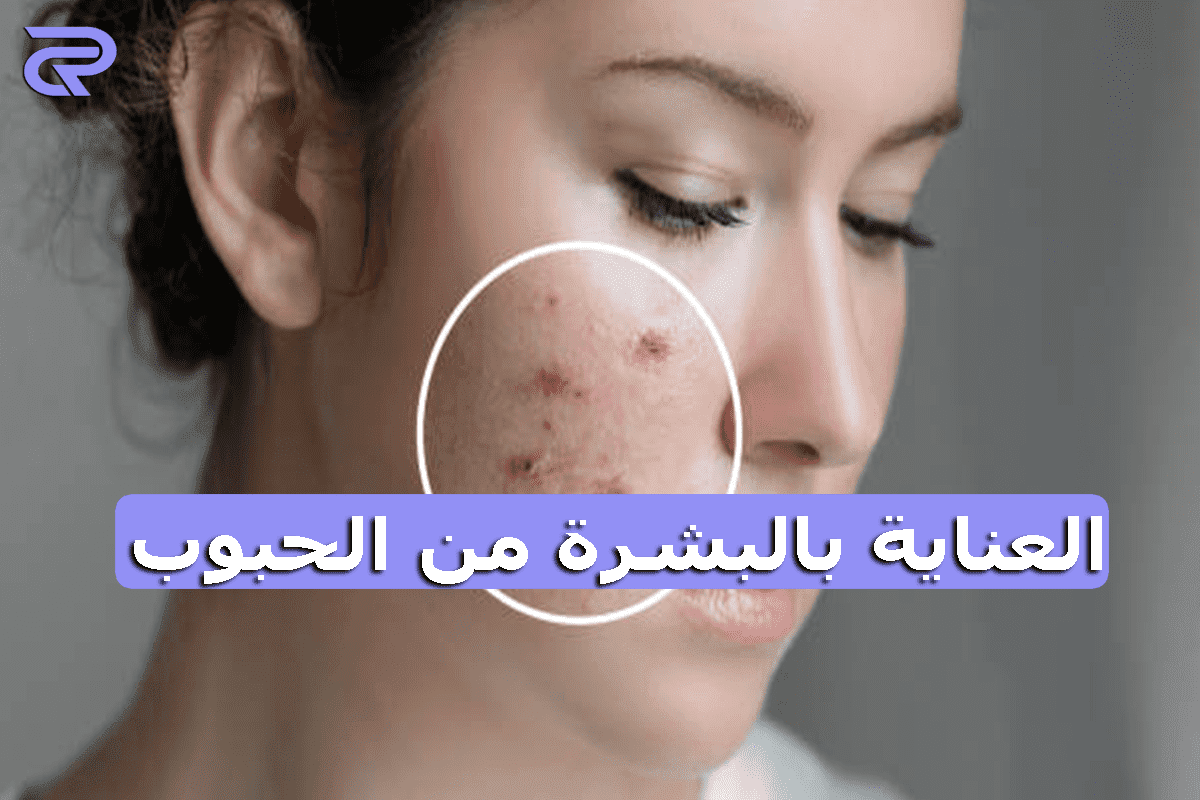 العناية بالبشرة من الحبوب: استهلك هذه الأشياء لجعل الوجه لامعا وخالية من حب الشباب