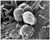 Bakteri gonore Bakteri gonore