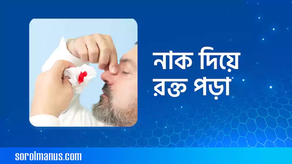 নাক দিয়ে রক্ত পড়ার কারণ এবং এর চিকিৎসা