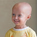 Progeria - Hutchinson-Gilford Progeria Syndrome