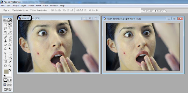 Tips Menghapus Jerawat dengan Photoshop Secara Cepat