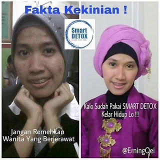 Jual Smart Detox Synergy  di Wilayah Tangerang, Kota Tangerang WhatsApp: 6281319308376