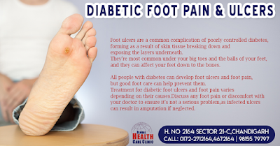 Diabetic Foot Surgery in Chandigarh