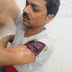 किराना व्यवसाई के दूकान पर ताबड़तोड़ गोलीबारी से सहमा इलाका, व्यवसाई जख्मी
