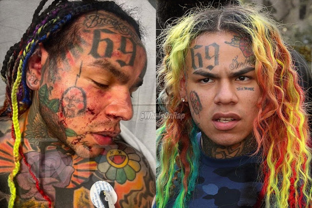 Tekashi 6ix9ine left bruised and bloodied after ambush attack inside ... bad the controversial rapper was rushed to a hospital by ambulance.