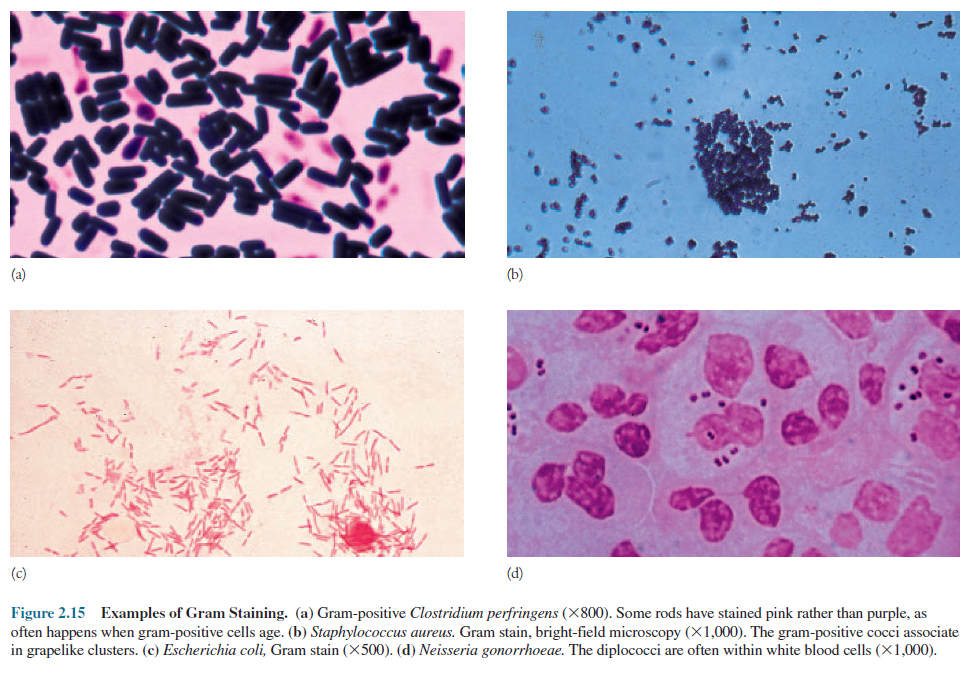 Examples of gram staining