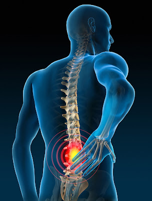 Neuromodulation Devices