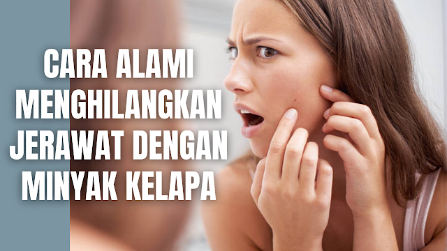 Cara Alami Menghilangkan Jerawat Dengan Minyak Kelapa Minyak kelapa mengandung asam lemak rantai menengah, termasuk asam laurat. Asam laurat menunjukkan sifat anti-inflamasi dan antimikroba yang memerangi bakteri penyebab jerawat.  Cara Menggunakan Minyak Kelapa Untuk Menghilangkan Jerawat Berikut ini adalah cara-cara di dalam menggunakan minyak kelapa untuk menghilangkan jerawat :  Ambil satu sendok makan minyak kelapa murni di telapak tangan Pijat secara merata di wajah Diamkan minyak selama 30 menit sebelum dibilas Lakukan ini sekali atau dua kali sehari   Nah itu dia bahasan mengenai bagaimana cara menghilangkan jerawat dengan minyak kelapa, melalui bahasan di atas bisa diketahui mengenai tahapan-tahapan yang dilakukan di dalam menggunakan minyak kelapa sebagai penghilang jerawat. Mungkin hanya itu yang bisa disampaikan di dalam artikel ini, mohon maaf bila terjadi kesalahan di dalam penulisan, dan terimakasih telah membaca artikel ini."God Bless and Protect Us"