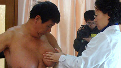 Chinese Man With World's Biggest Breast