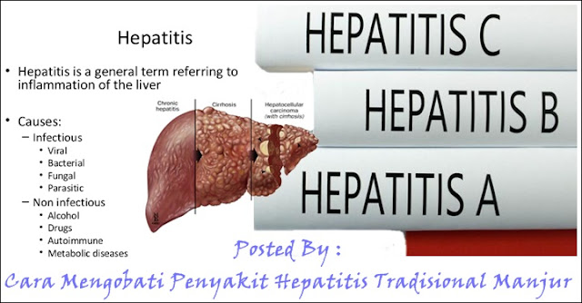 Tanda-Tanda Dari Penyakit Hepatitis