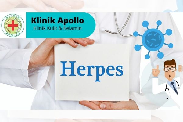 dampak akibat penyakit herpes