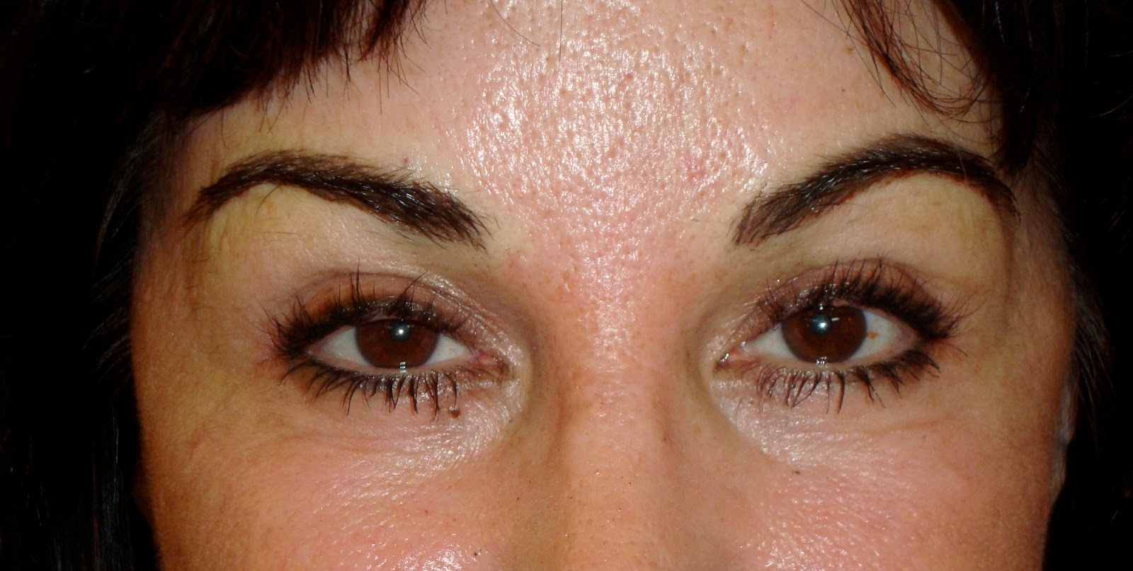 Permanent Makeup Beauty: Different Tattoo Removal Methods