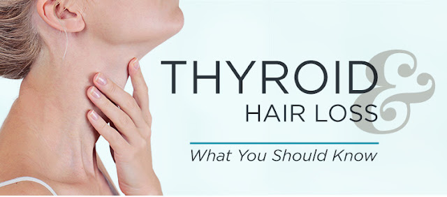 Thyroid and Hair Loss