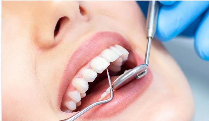 Some FAQS on Dental Insurance and Dental Plan