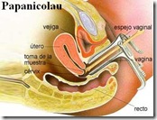 Papanicolau