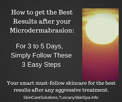 3 simple at-home, skincare steps to help you get the best after your aggressive  treatments by http://skincaresolutions.tuscanyskinspa.info